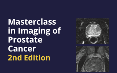 Masterclass in Imaging of Prostate Cancer